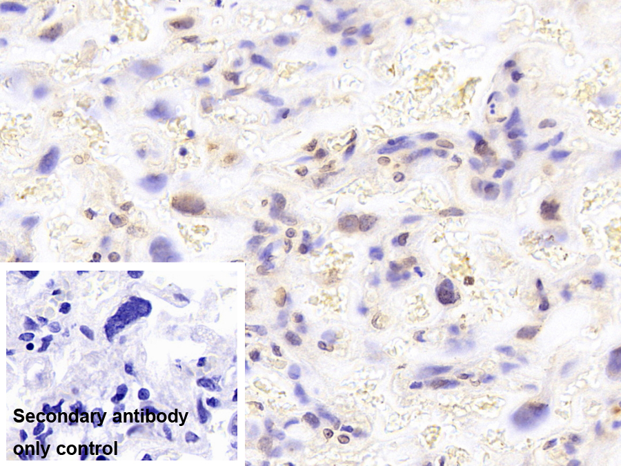 Monoclonal Antibody to Liver Receptor Homolog 1 (LRH1)