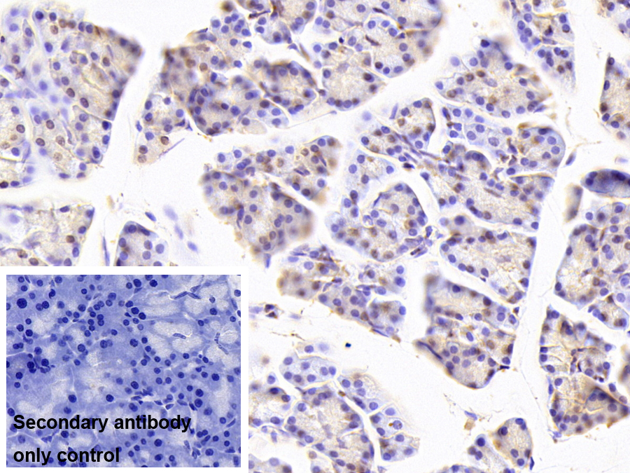 Monoclonal Antibody to Liver Receptor Homolog 1 (LRH1)
