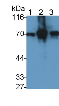 Monoclonal Antibody to Neurofilament, Light Polypeptide (NEFL)