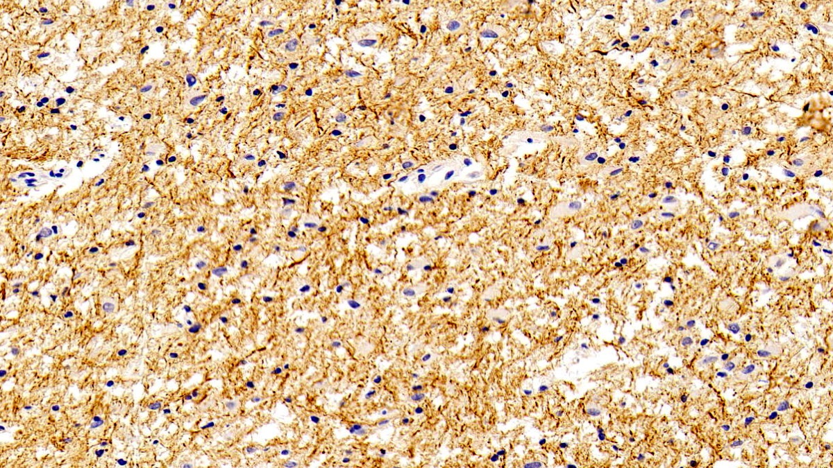 Monoclonal Antibody to Neurofilament, Light Polypeptide (NEFL)