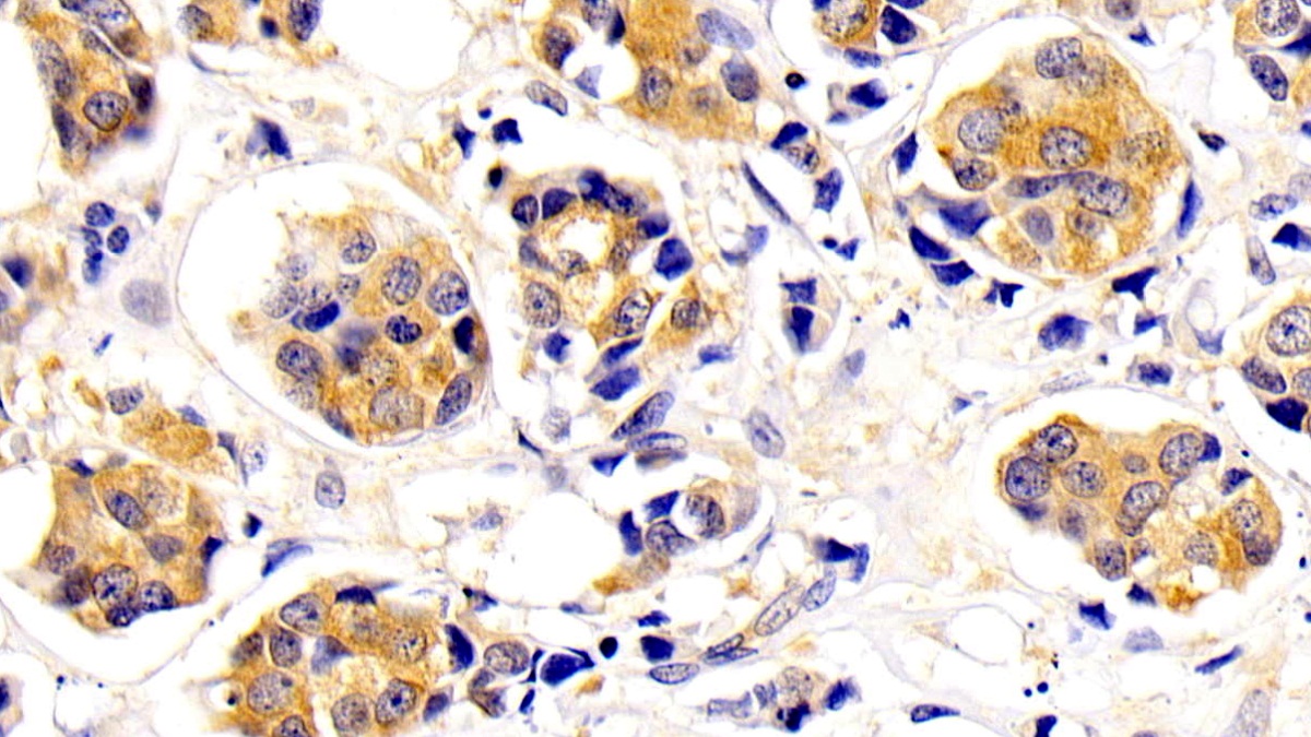 Monoclonal Antibody to Neurofilament, Light Polypeptide (NEFL)