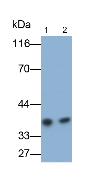 Monoclonal Antibody to Ephrin A3 (EFNA3)
