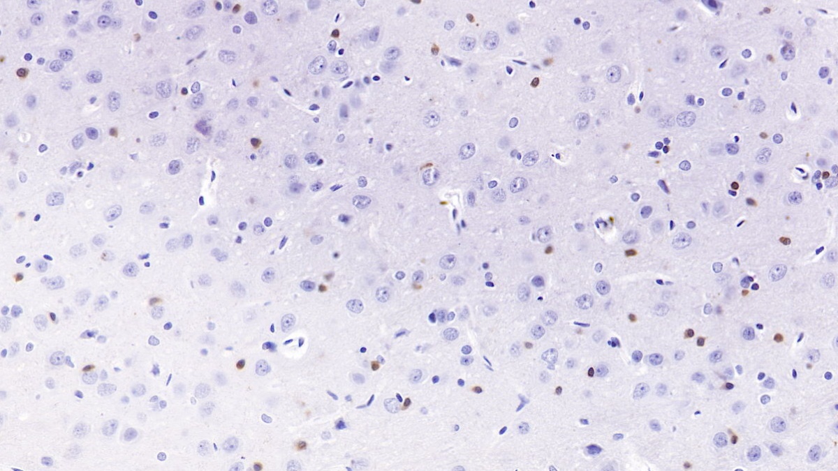 Monoclonal Antibody to Proprotein Convertase Subtilisin/Kexin Type 9 (PCSK9)