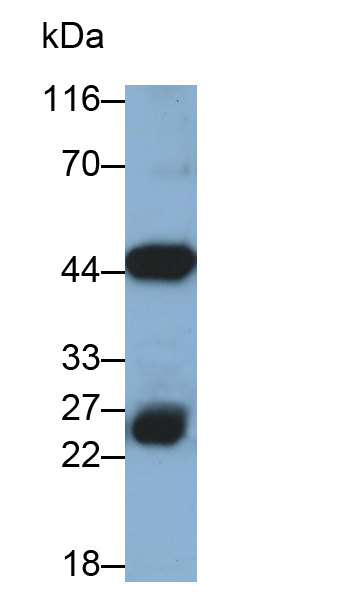 Monoclonal Antibody to 4-Hydroxyphenylpyruvate Dioxygenase (HPD)