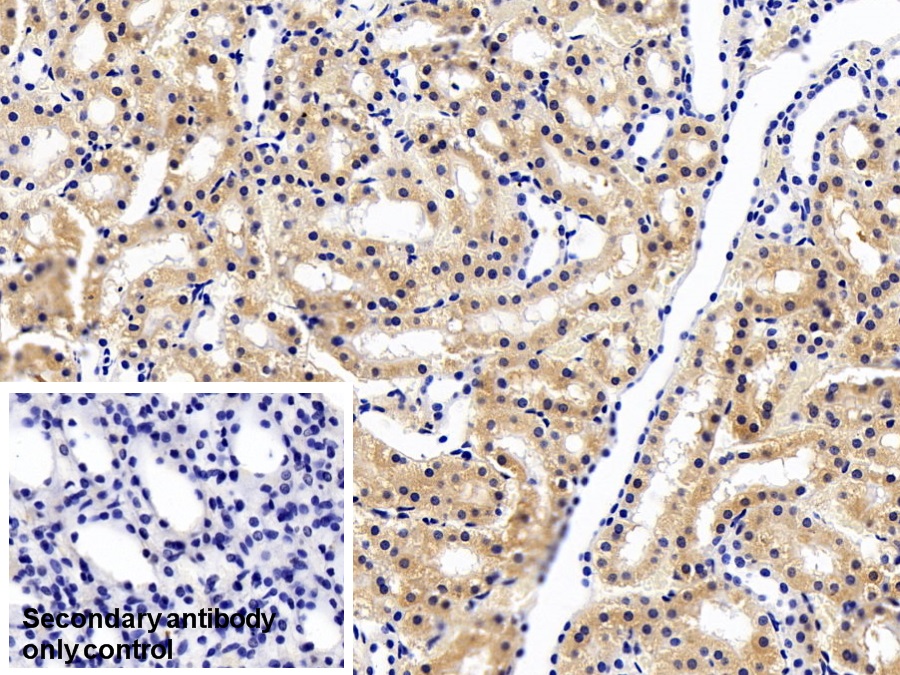 Monoclonal Antibody to 4-Hydroxyphenylpyruvate Dioxygenase (HPD)