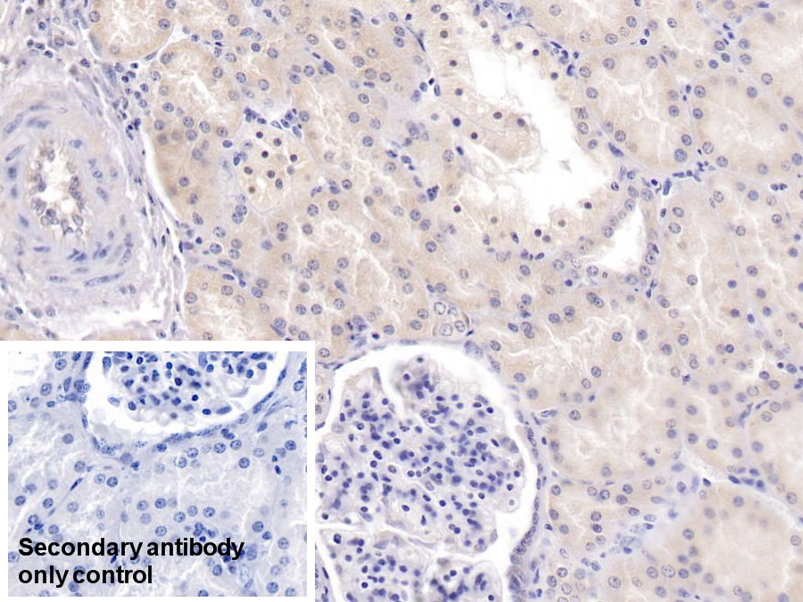 Monoclonal Antibody to Tryptophan-2,3-dioxygenase (TDO)