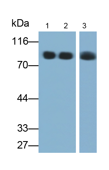 Monoclonal Antibody to Alpha-1-B-Glycoprotein (a1BG)