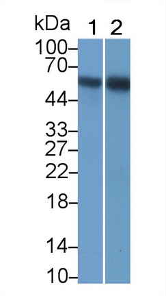 Monoclonal Antibody to Receptor Interacting Serine Threonine Kinase 3 (RIPK3)