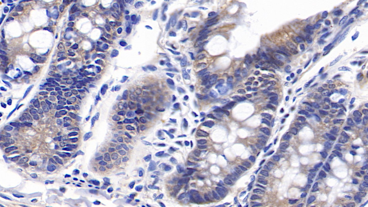 Monoclonal Antibody to Receptor Interacting Serine Threonine Kinase 3 (RIPK3)