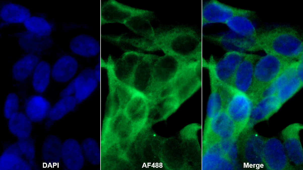 Monoclonal Antibody to Regenerating Islet Derived Protein 3 Alpha (REG3a)