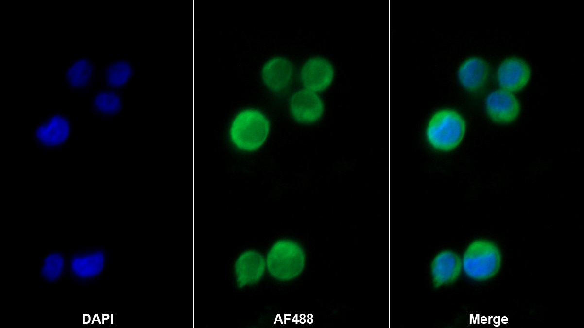 Monoclonal Antibody to Inhibitory Subunit Of NF Kappa B Epsilon (IkBe)