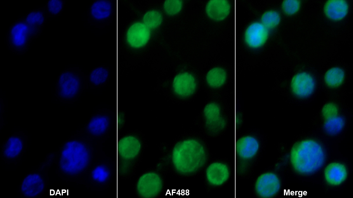 Monoclonal Antibody to Inhibitory Subunit Of NF Kappa B Epsilon (IkBe)