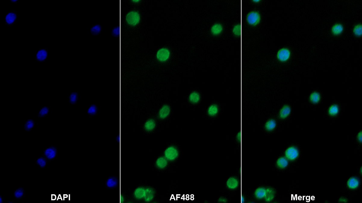 Monoclonal Antibody to Inhibitory Subunit Of NF Kappa B Epsilon (IkBe)