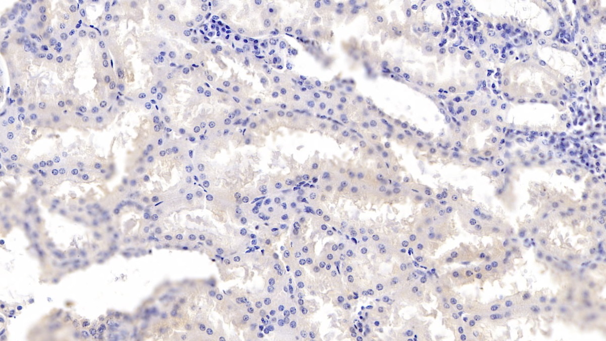 Monoclonal Antibody to Annexin A3 (ANXA3)