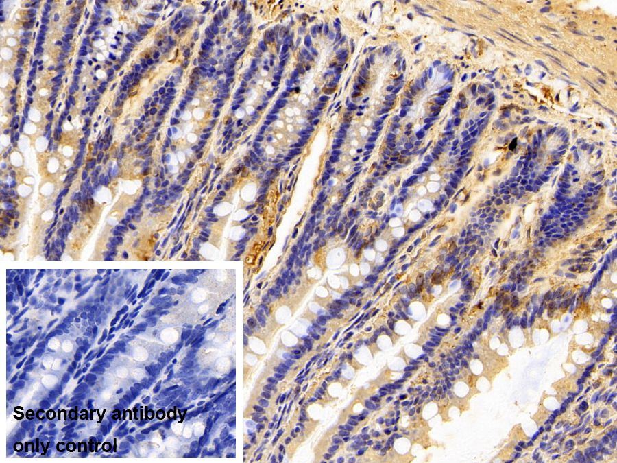 Monoclonal Antibody to Complement Component 1, Q Subcomponent C (C1qC)