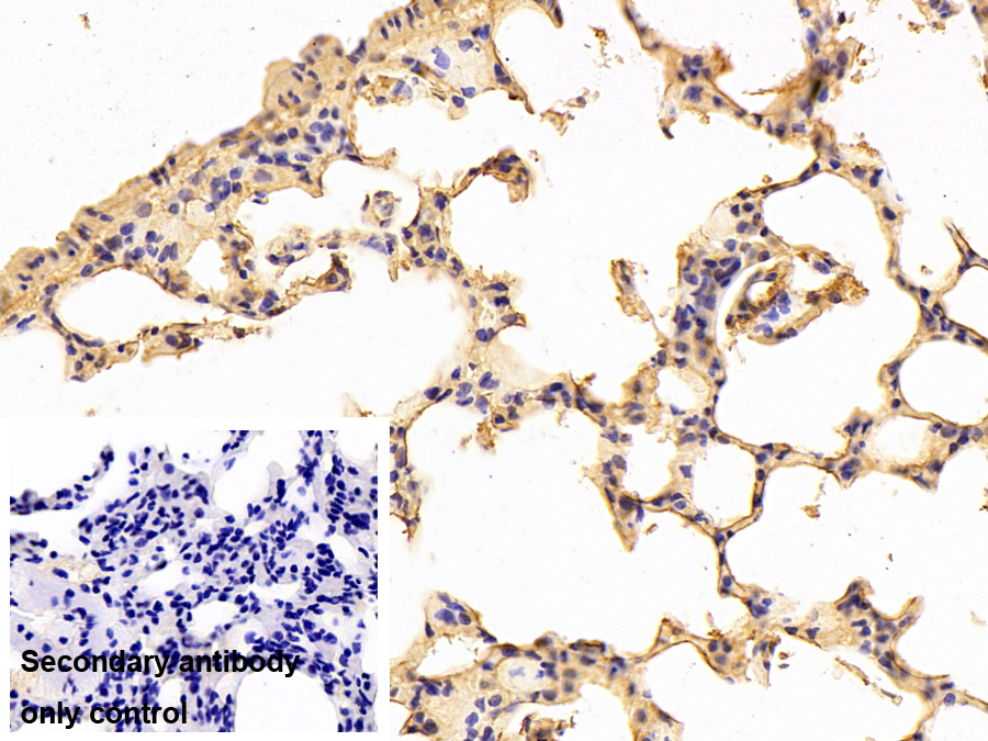 Monoclonal Antibody to Complement Component 1, Q Subcomponent C (C1qC)
