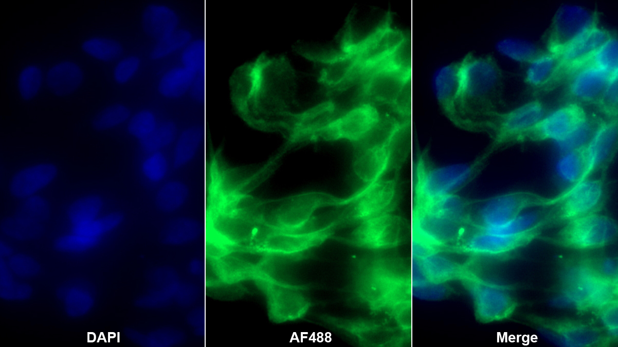 Monoclonal Antibody to Complement Component 1, Q Subcomponent C (C1qC)