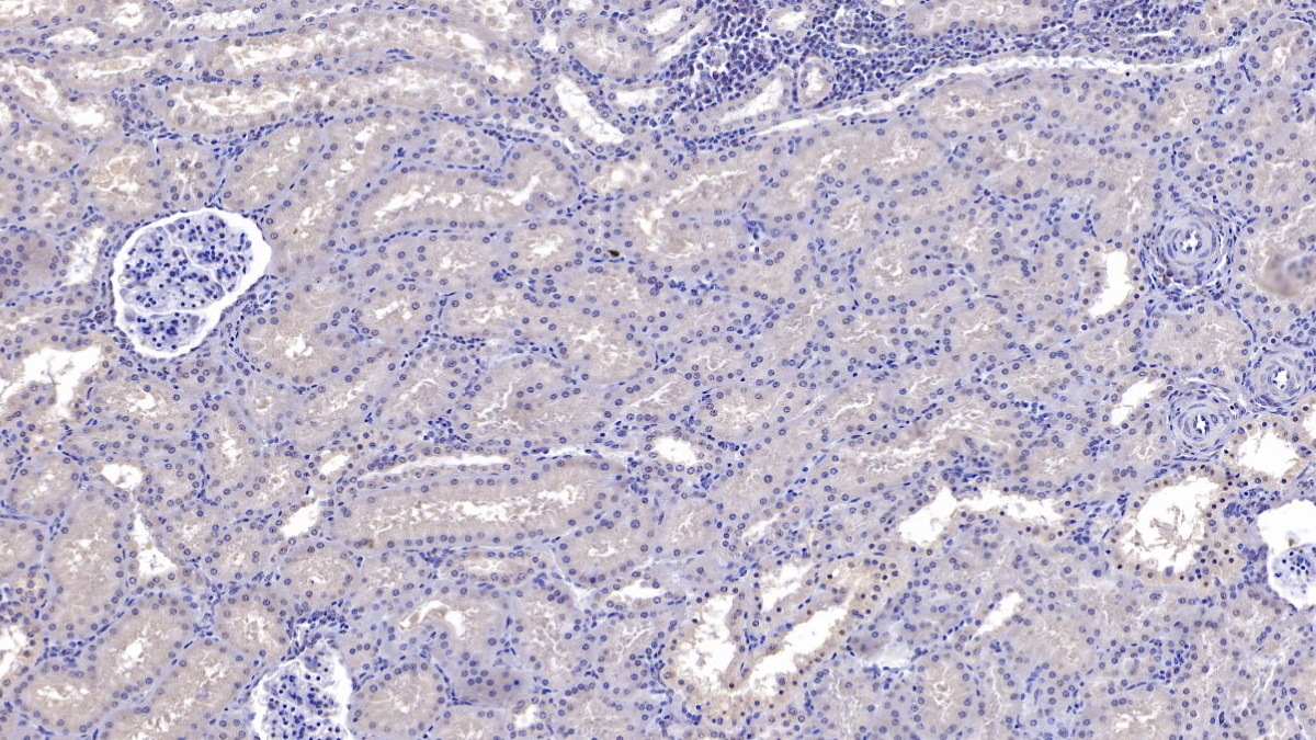 Monoclonal Antibody to Sirtuin 3 (SIRT3)