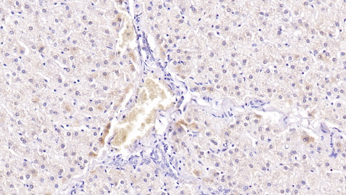 Monoclonal Antibody to Sirtuin 3 (SIRT3)