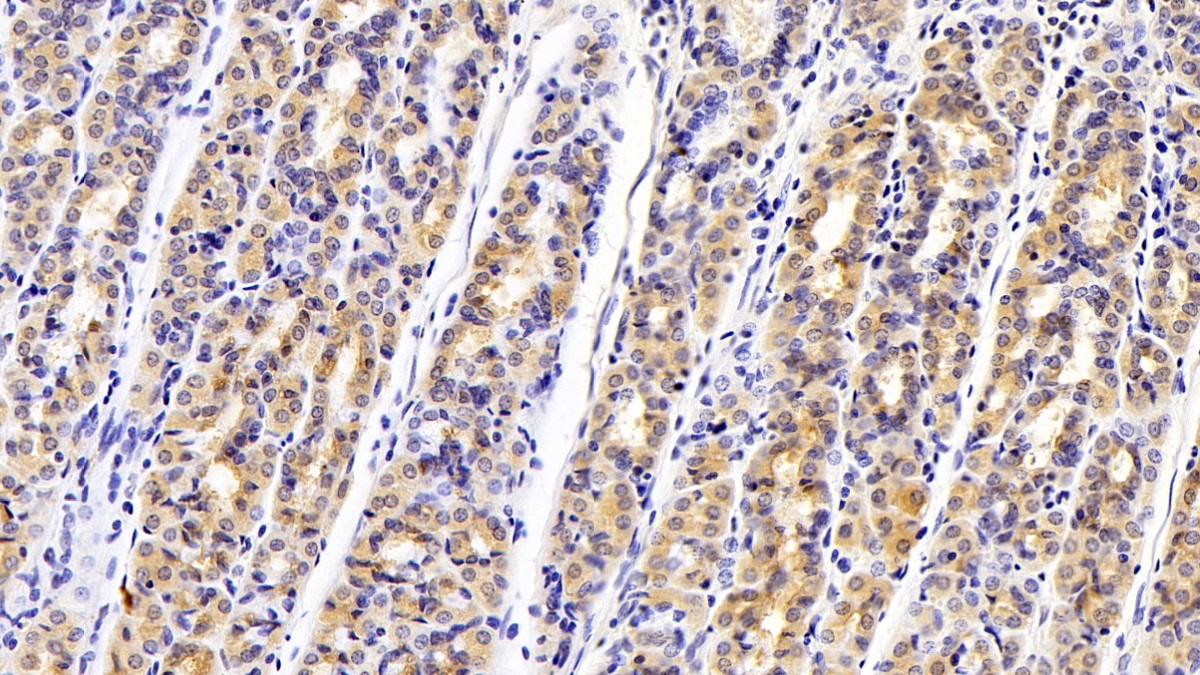 Monoclonal Antibody to Anthrax Toxin Receptor 2 (ANTXR2)