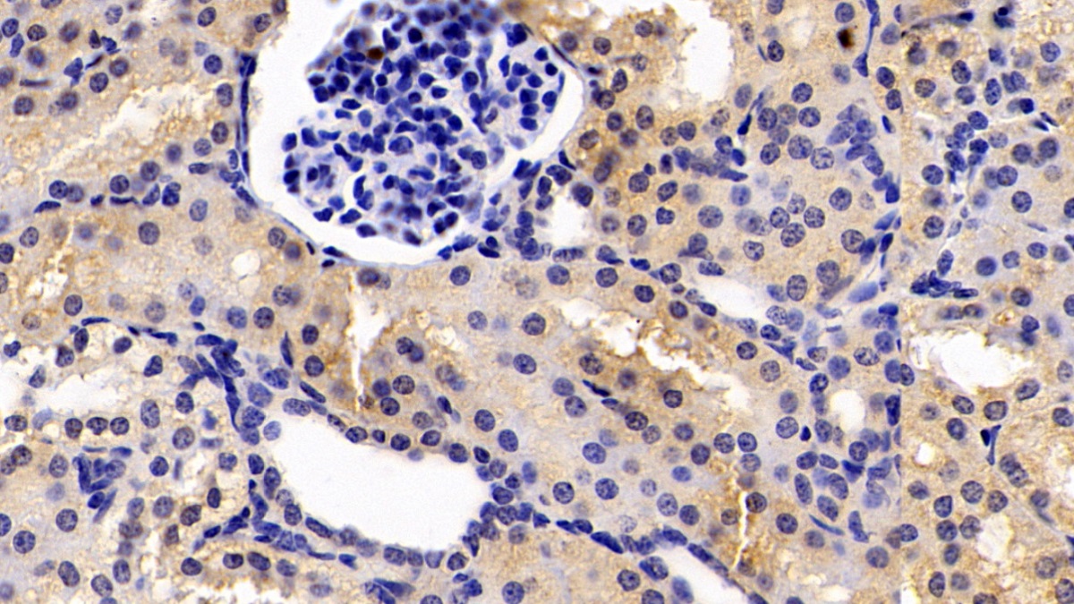 Monoclonal Antibody to Anthrax Toxin Receptor 2 (ANTXR2)