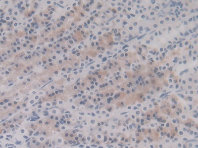Monoclonal Antibody to Heat Shock Protein Beta 6 (HSPb6)
