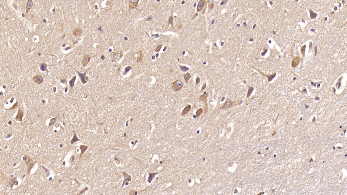 Monoclonal Antibody to Doublecortin Like Kinase 1 (DCLK1)