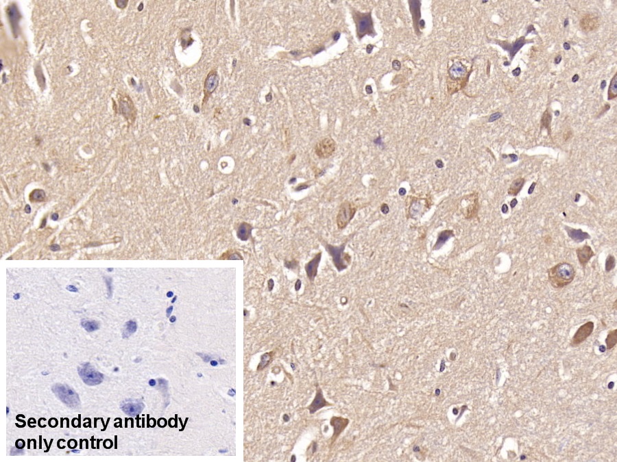 Monoclonal Antibody to Doublecortin Like Kinase 1 (DCLK1)