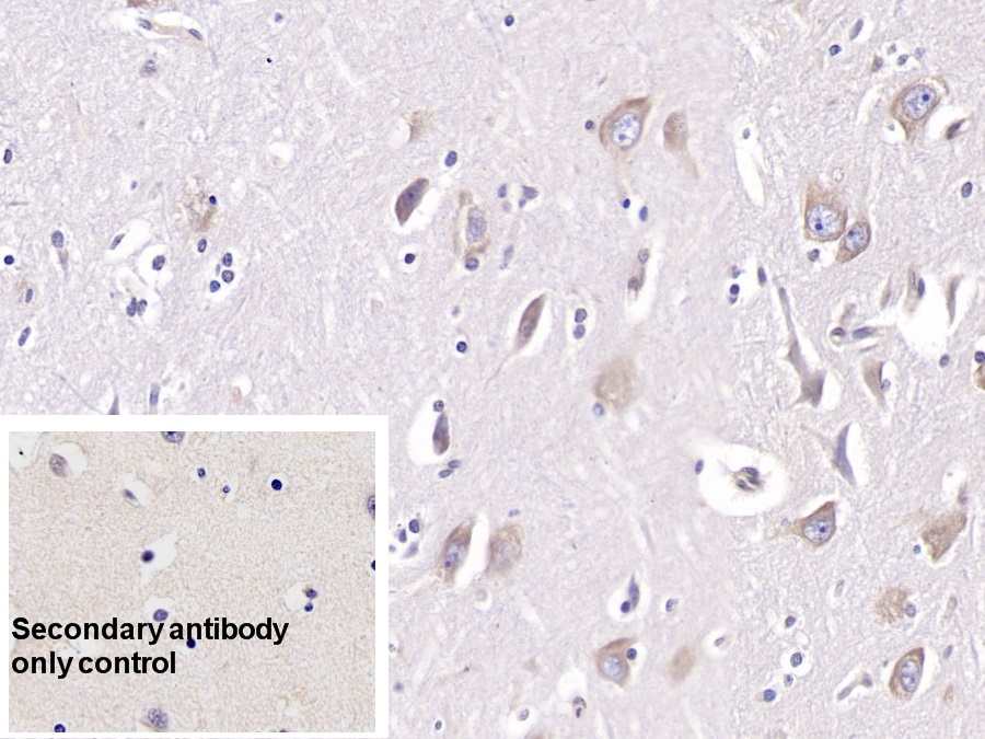 Monoclonal Antibody to Doublecortin Like Kinase 1 (DCLK1)