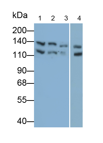 Monoclonal Antibody to Janus Kinase 2 (JAK2)
