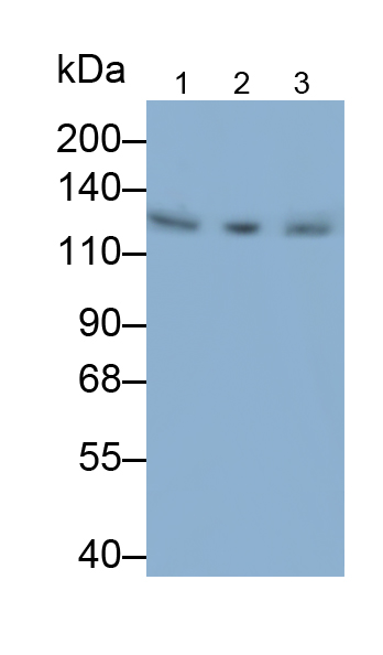 Monoclonal Antibody to Janus Kinase 2 (JAK2)