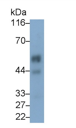 Monoclonal Antibody to Kisspeptin Receptor (KISS1R)