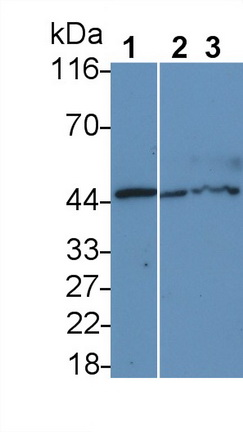 Monoclonal Antibody to Phosphatase And Tensin Homolog (PTEN)