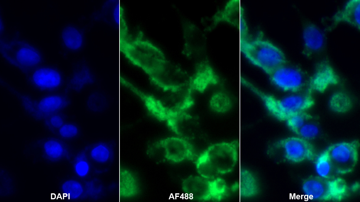 Monoclonal Antibody to Secreted Frizzled Related Protein 1 (SFRP1)