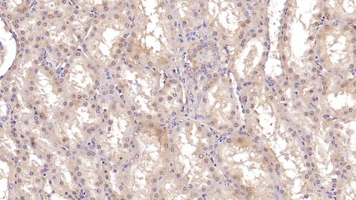 Monoclonal Antibody to Aspartate Beta Hydroxylase (ASPH)