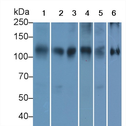 Monoclonal Antibody to ATPase, Na+/K+ Transporting Alpha 1 Polypeptide (ATP1a1)