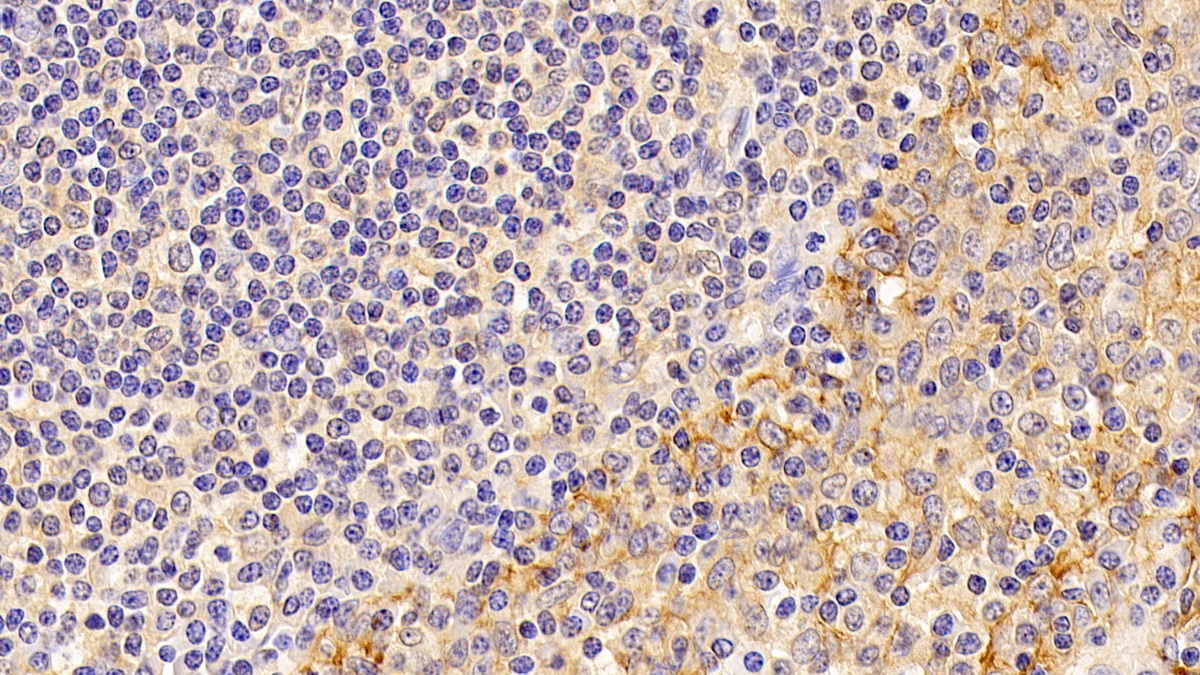 Monoclonal Antibody to ATPase, Na+/K+ Transporting Alpha 1 Polypeptide (ATP1a1)