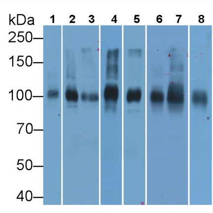 Monoclonal Antibody to ATPase, Na+/K+ Transporting Alpha 1 Polypeptide (ATP1a1)