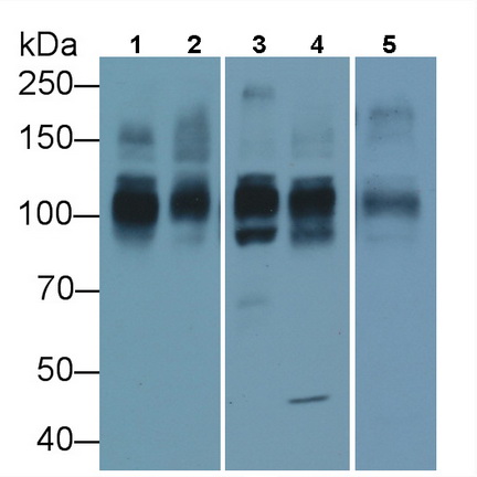 Monoclonal Antibody to ATPase, Na+/K+ Transporting Alpha 1 Polypeptide (ATP1a1)