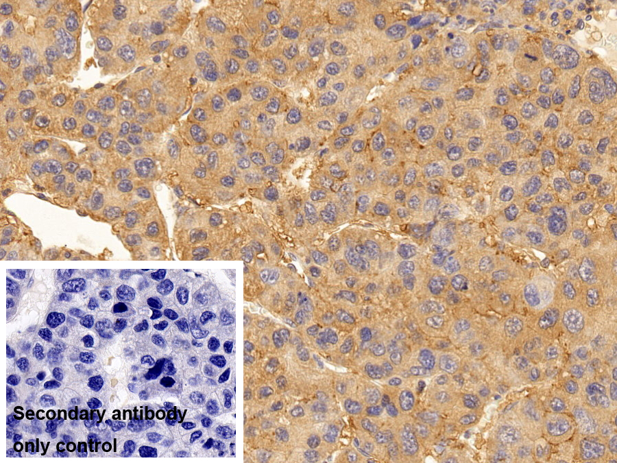 Monoclonal Antibody to ATPase, Na+/K+ Transporting Alpha 1 Polypeptide (ATP1a1)