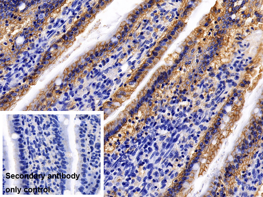 Monoclonal Antibody to ATPase, Na+/K+ Transporting Alpha 1 Polypeptide (ATP1a1)