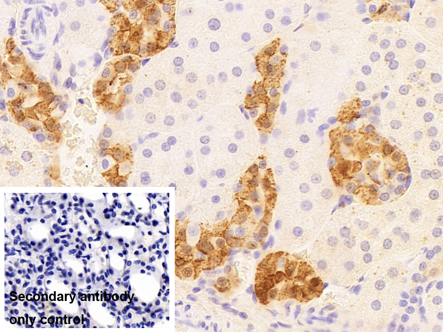 Monoclonal Antibody to Calbindin (CALB)