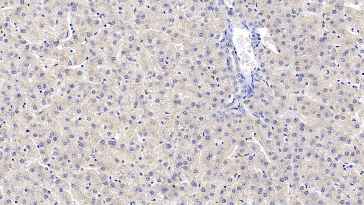 Monoclonal Antibody to Microtubule Associated Protein RP/EB Family, Member 1 (MAPRE1)