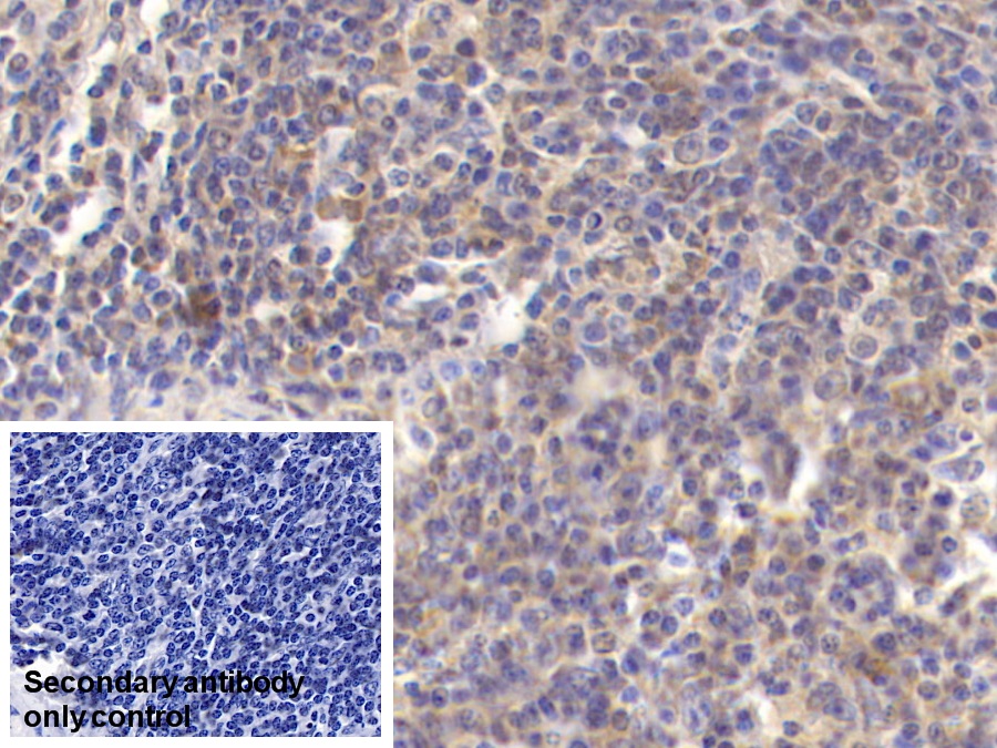 Monoclonal Antibody to Microtubule Associated Protein RP/EB Family, Member 1 (MAPRE1)