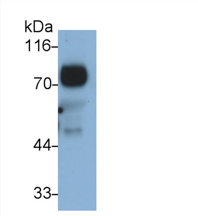 Monoclonal Antibody to Transcobalamin I (TCN1)