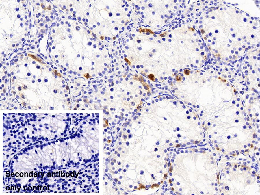Monoclonal Antibody to Ubiquitin Carboxyl Terminal Hydrolase L1 (UCHL1)