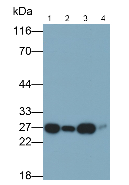 Monoclonal Antibody to Ubiquitin Carboxyl Terminal Hydrolase L1 (UCHL1)