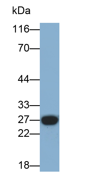 Monoclonal Antibody to Ubiquitin Carboxyl Terminal Hydrolase L1 (UCHL1)