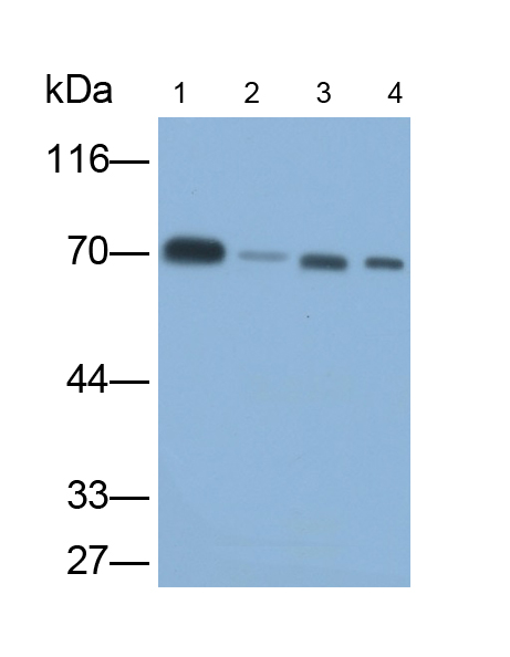 Monoclonal Antibody to Transketolase (TKT)