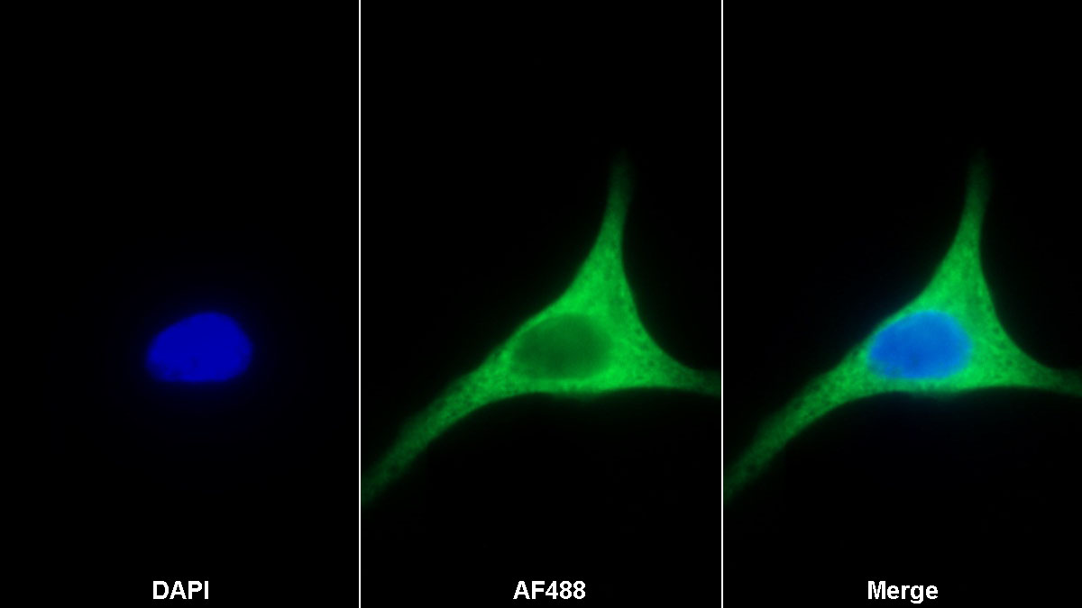 Monoclonal Antibody to Periostin (POSTN)